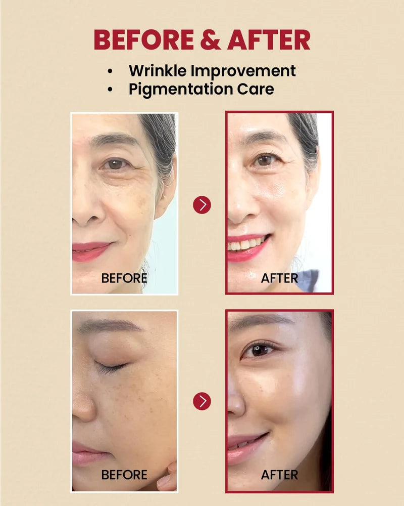 Seoal Retinal K‑SECRET - SEOUL 1988 Serum: Retinal Liposome 2% + Black Ginseng ...